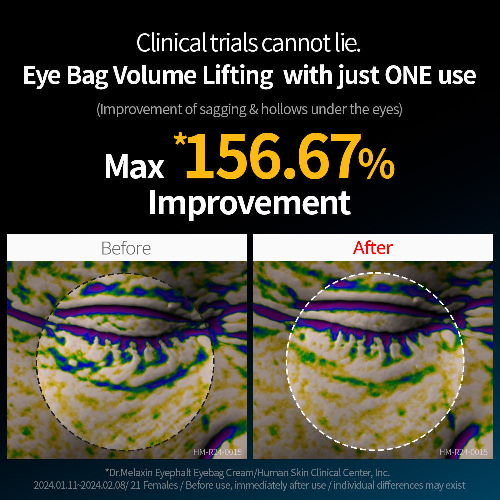 Dr.Melaxin EYEPHALT Eyecream for Eyebags 10ml