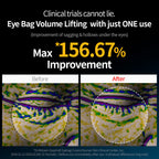 Dr.Melaxin EYEPHALT Eyecream for Eyebags 10ml