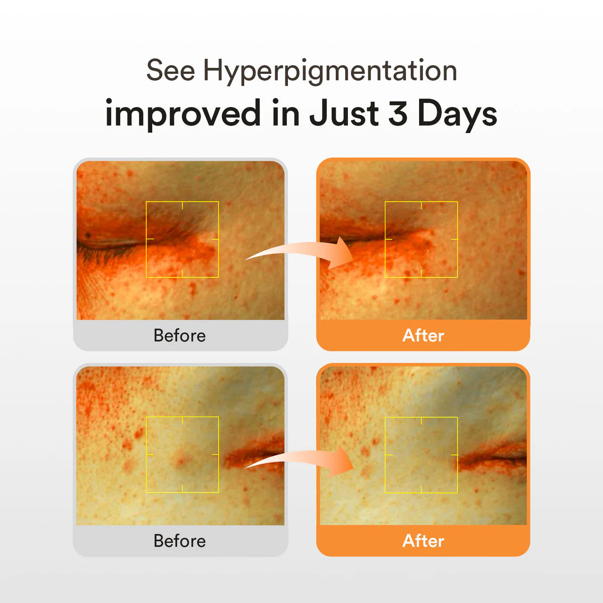 Abib Glutathiosome Dark Spot Serum Vita Drop 50ml