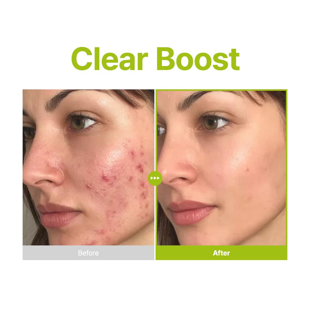 PURITO Azelaic Acid 10 Kojic Tea Tree Serum 30ml