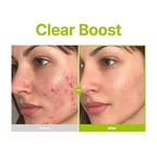 PURITO Azelaic Acid 10 Kojic Tea Tree Serum 30ml