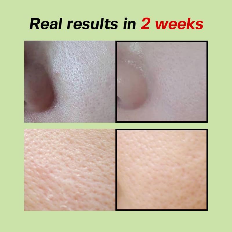 SUNGBOON EDITOR Green Tomato Pore Lifting Ampoule+ 30 ml