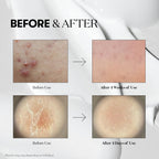 VT Reedle Shot 100 – Intensive Skin Renewal Serum