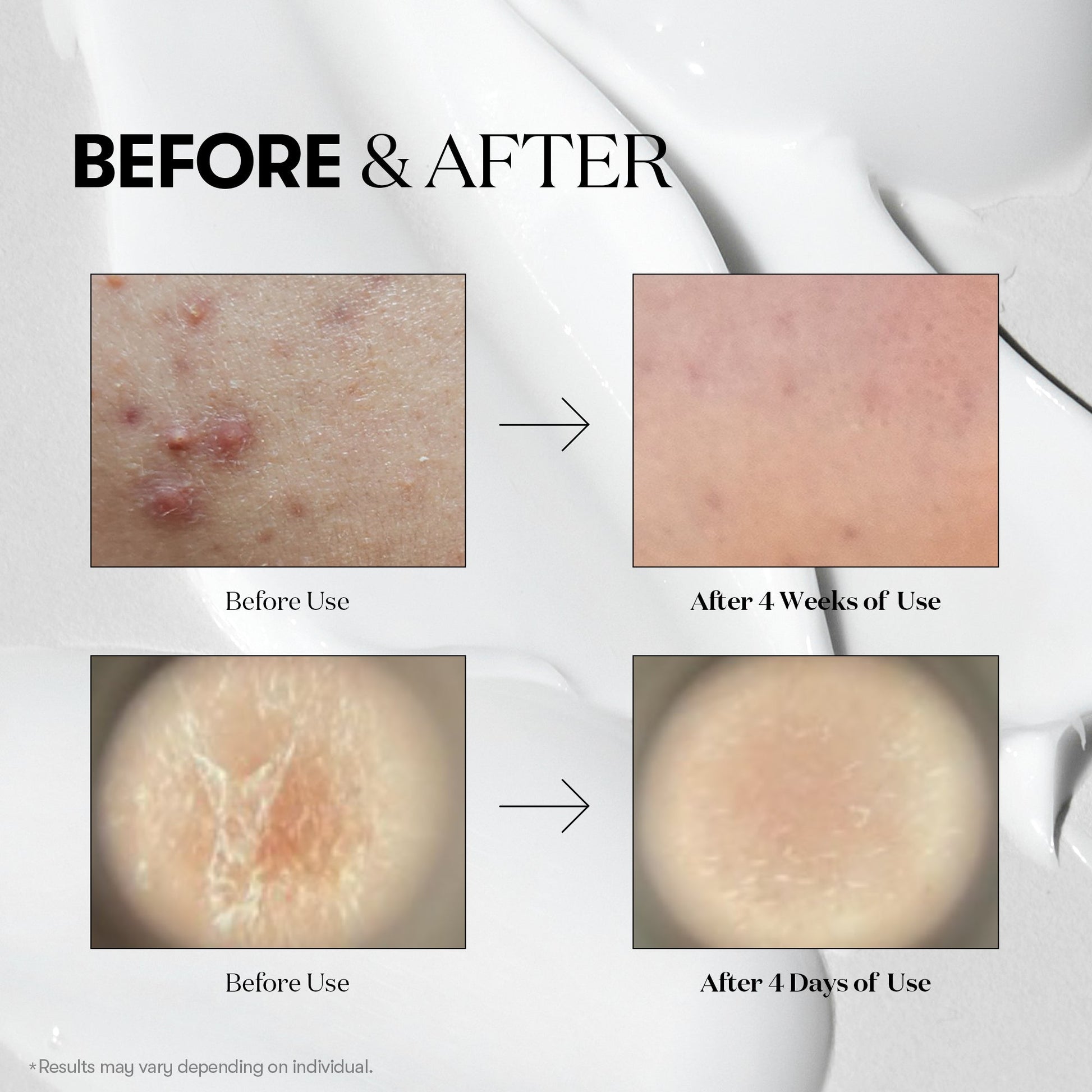 VT Reedle Shot 100 – Intensive Skin Renewal Serum