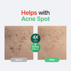 PURITO Wonder Releaf Centella Serum Unscented 60 ml | Soothing Barrier Repair Serum