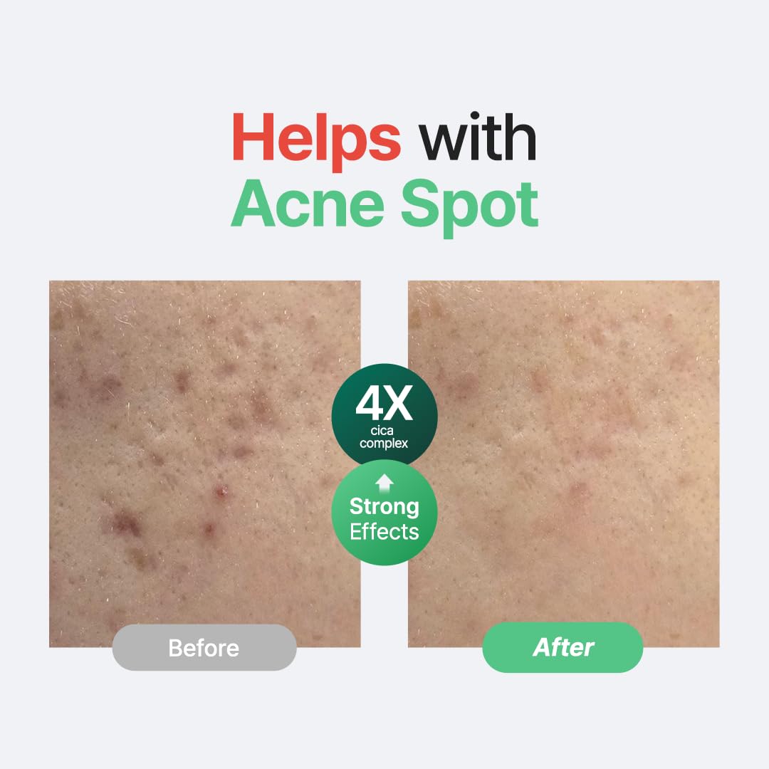 PURITO Wonder Releaf Centella Serum Unscented 60 ml | Soothing Barrier Repair Serum