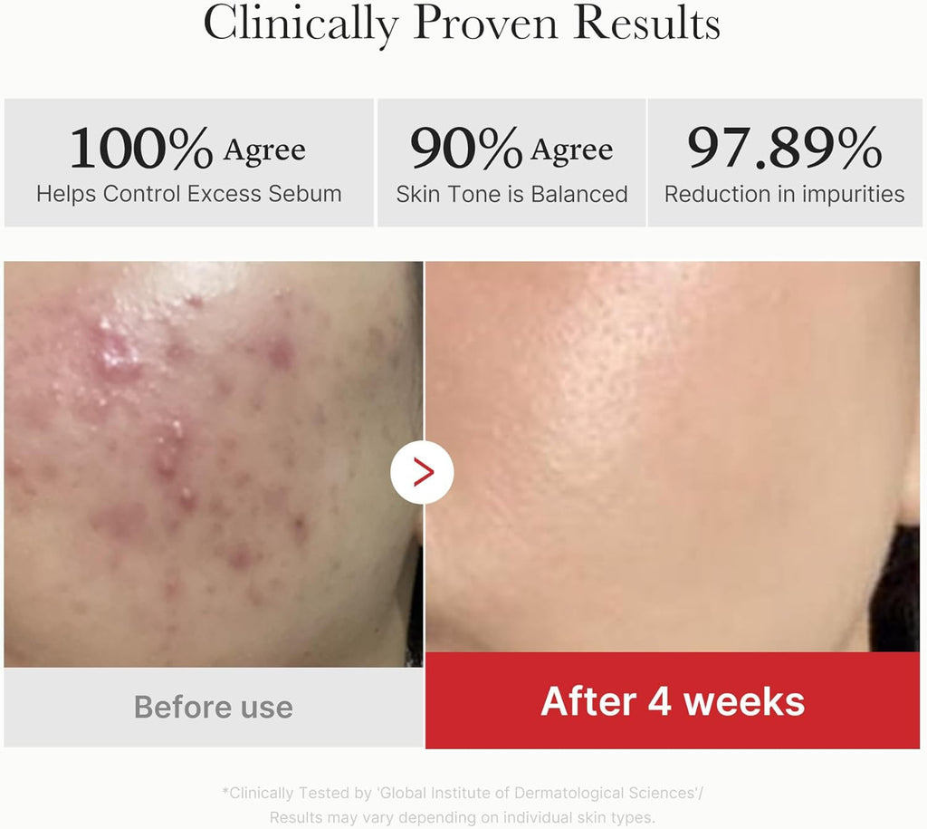 Medicube Red Succinic Peeling Pad 2024 (70 Pads) 155 g