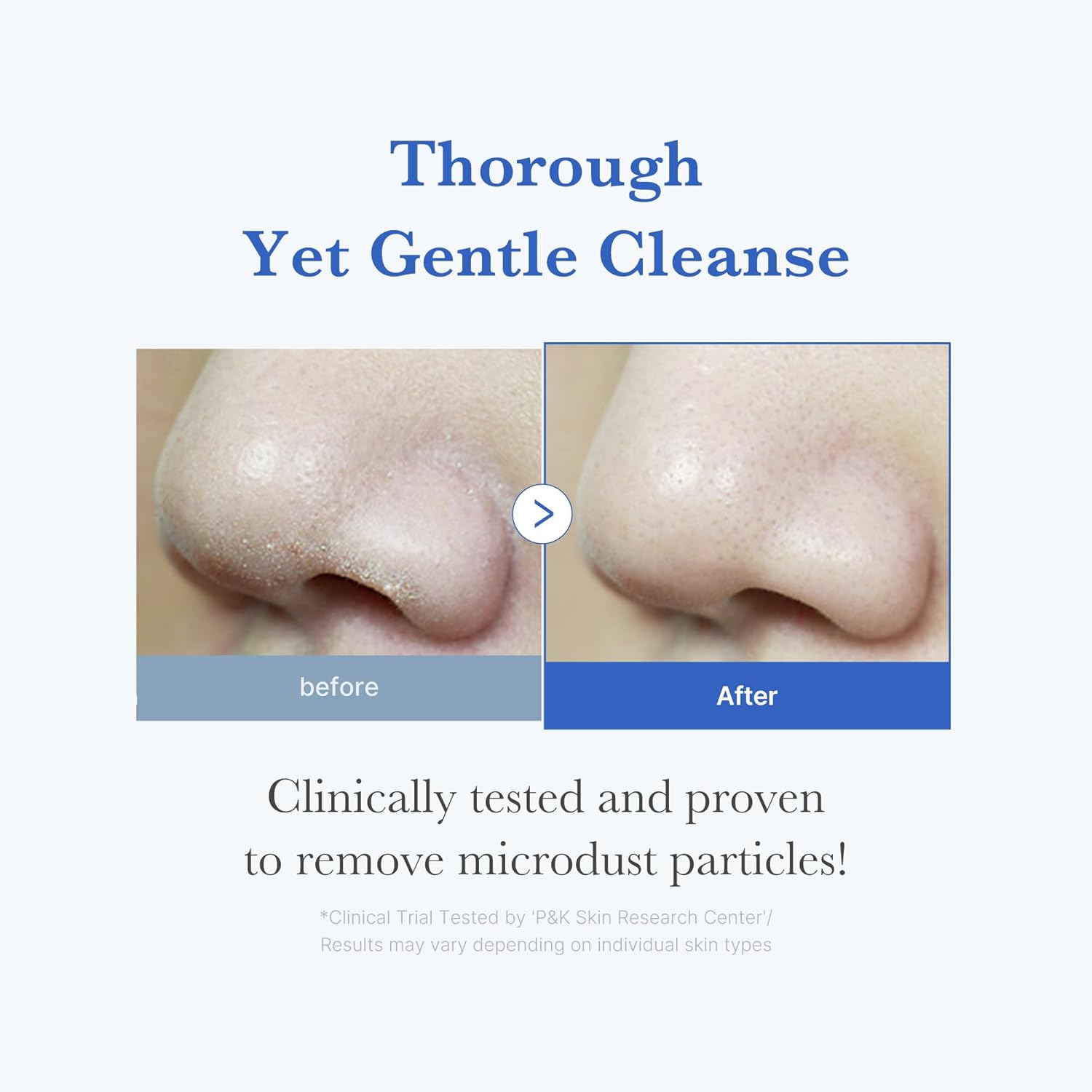 Medicube Zero Foam Cleanser – 120 ml