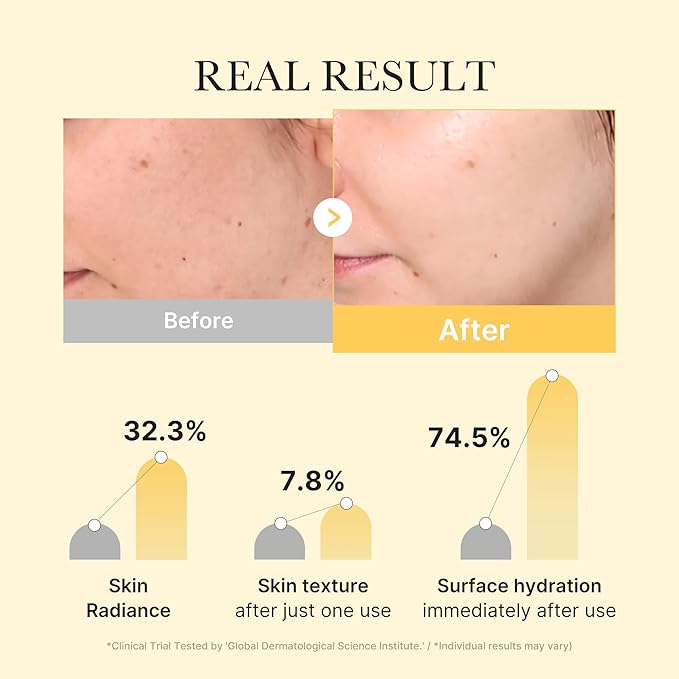 MEDICUBE Kojic Acid Turmeric Brightening Gel Mask 1pc