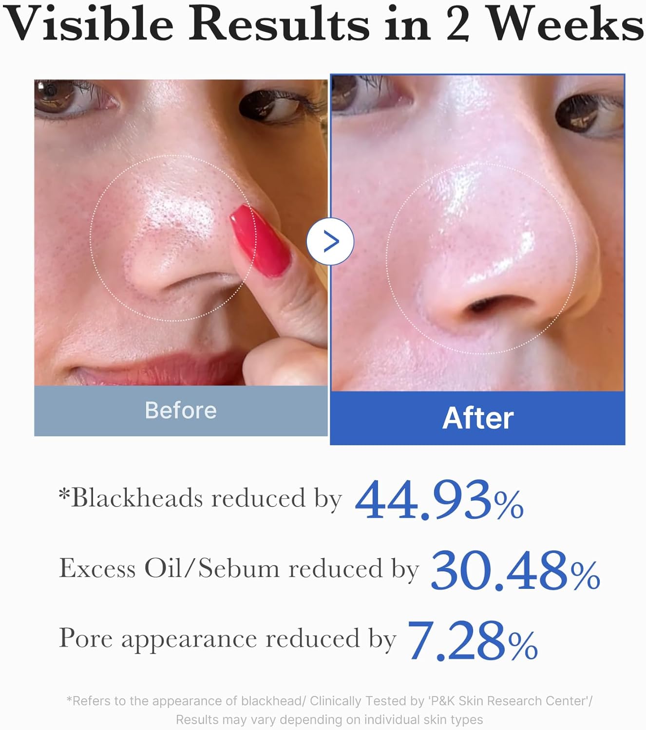 Medicube Zero Pore Pad 2.0 – 70 Pads