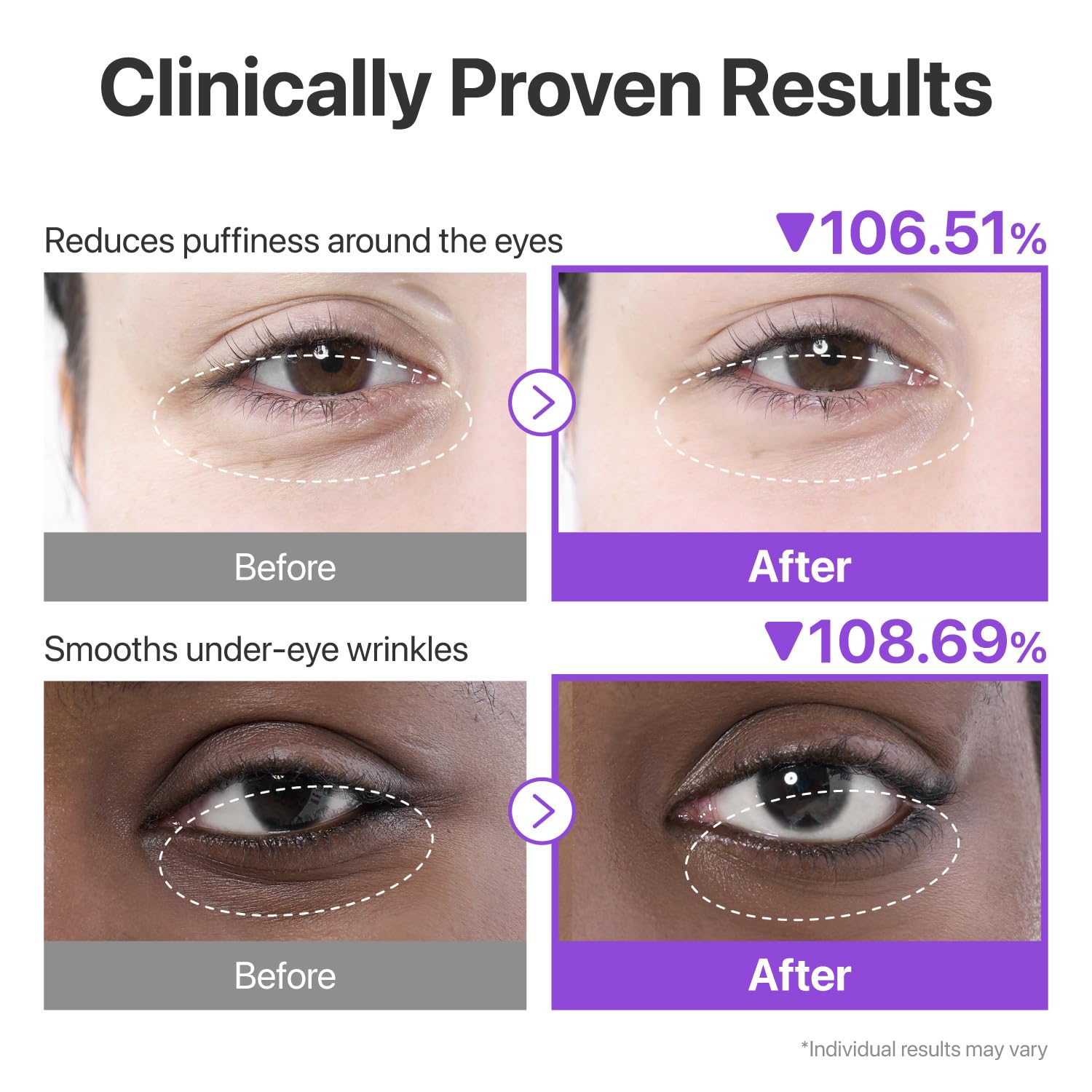 numbuzin No.9 NAD+ Collagen Under Eye Patches (5 Pairs)