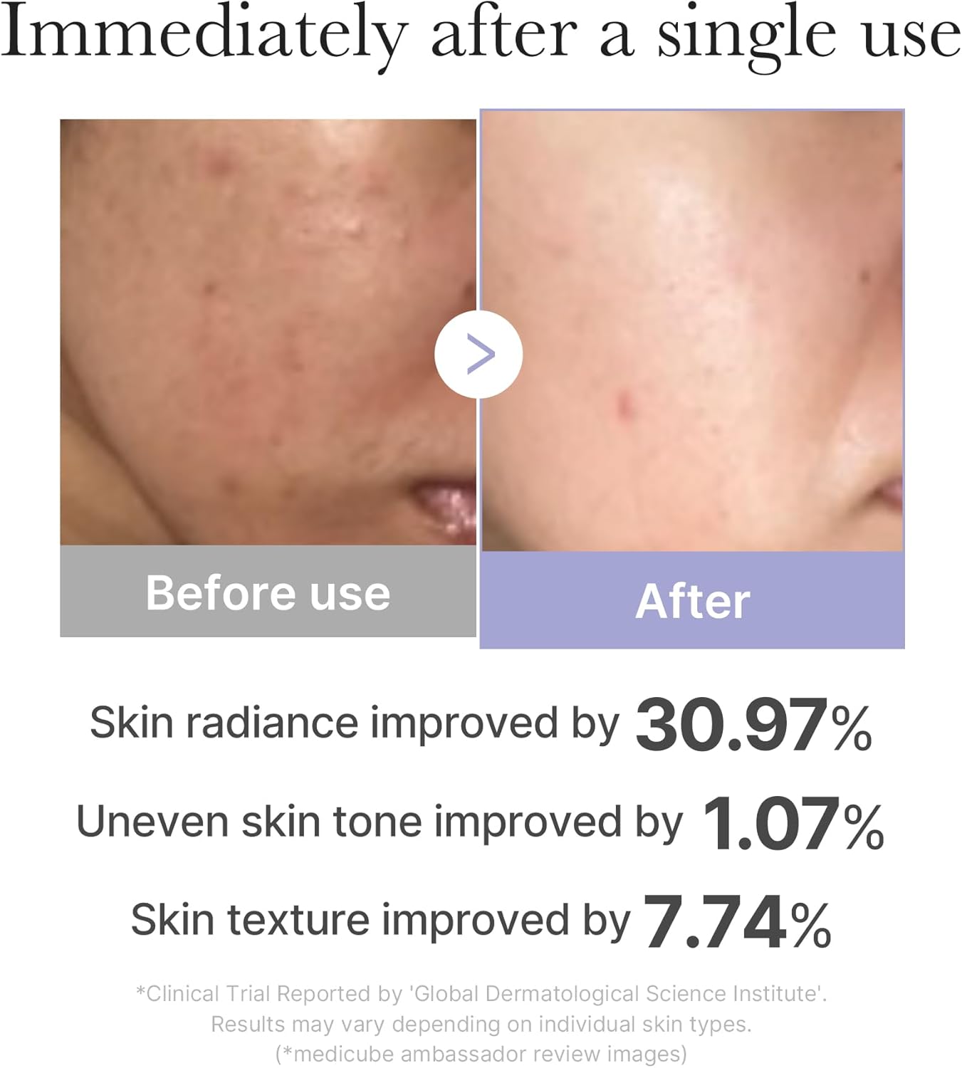 Medicube AGE-R Booster PRO Mini White