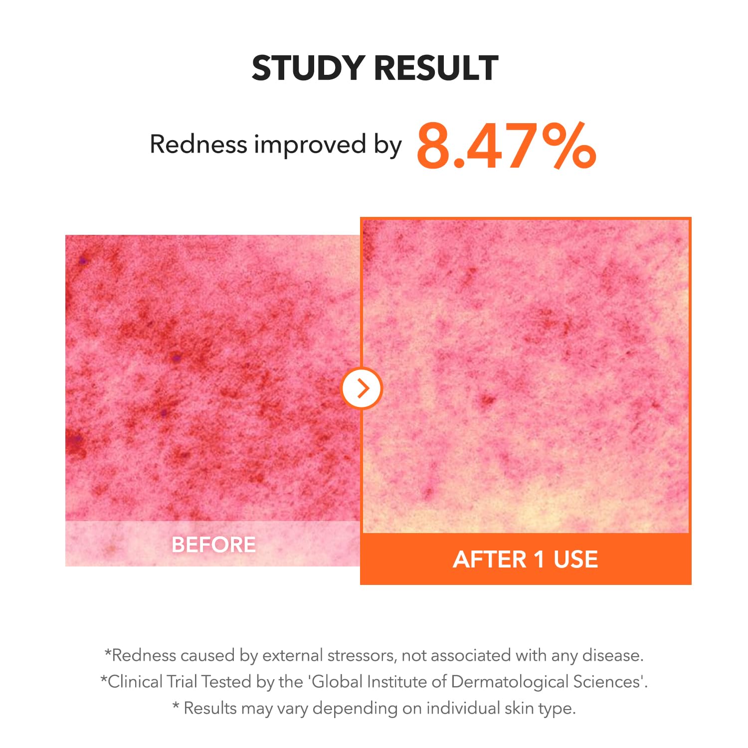 APRILSKIN Carrotene IPMP™ Clearing Solution 20ml
