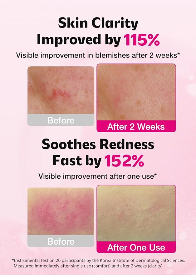 ISOI Brightening Serum 35ml