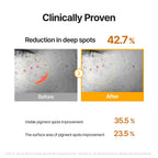 Celimax Pore+Dark Spot Brightening Serum 30ml