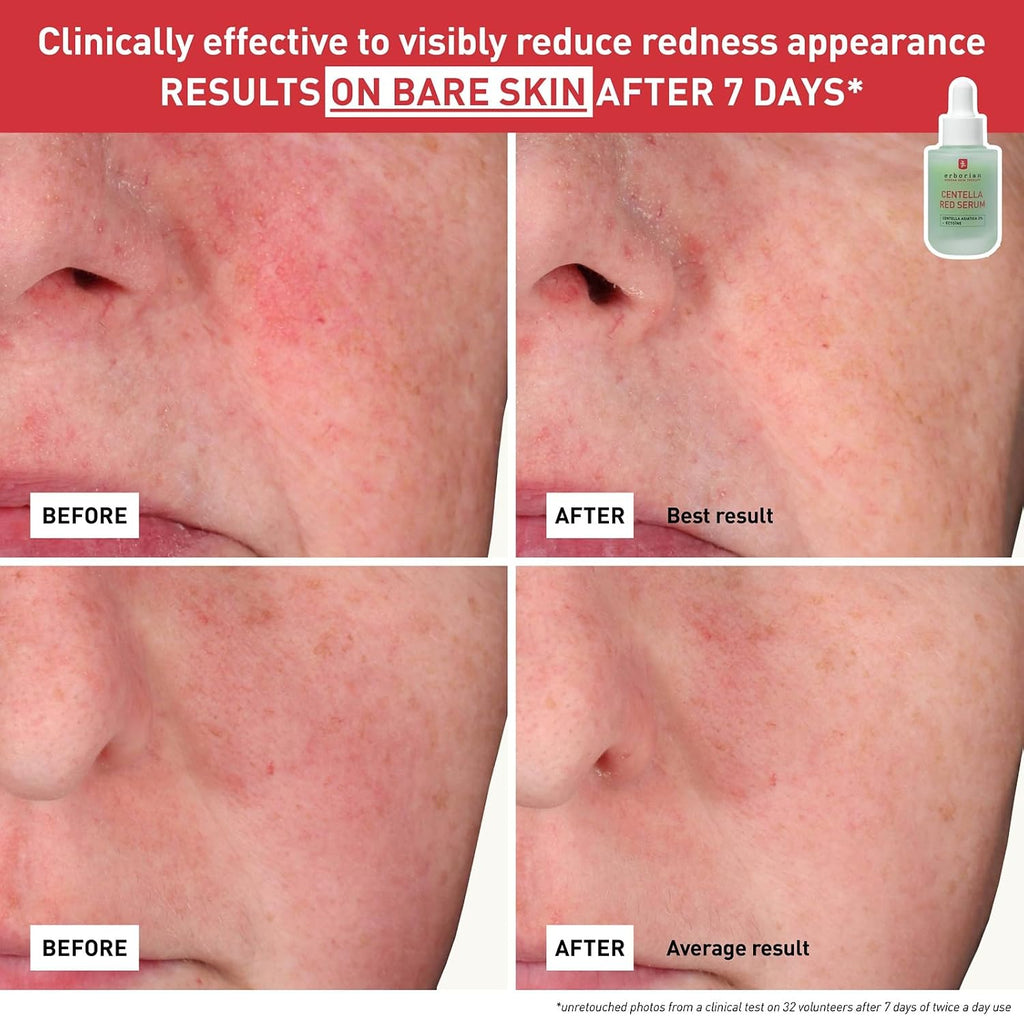 Erborian Centella Red Serum 30ml