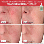 Erborian Centella Red Serum 30ml