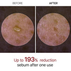 Dr. Melaxin Peel Shot Exfoliating White Rice Ampoule 80ml