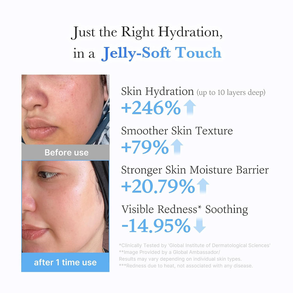 Medicube Hyaluronic Ceramide Moisturizing Jelly Cream 50ml