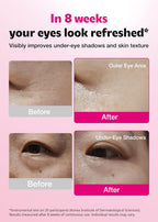ISOI Blemish Care Eye & Wrinkle Patch 90pcs