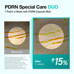 ANUA PDRN Collagen Melting Patch For Neck – 4 Patches