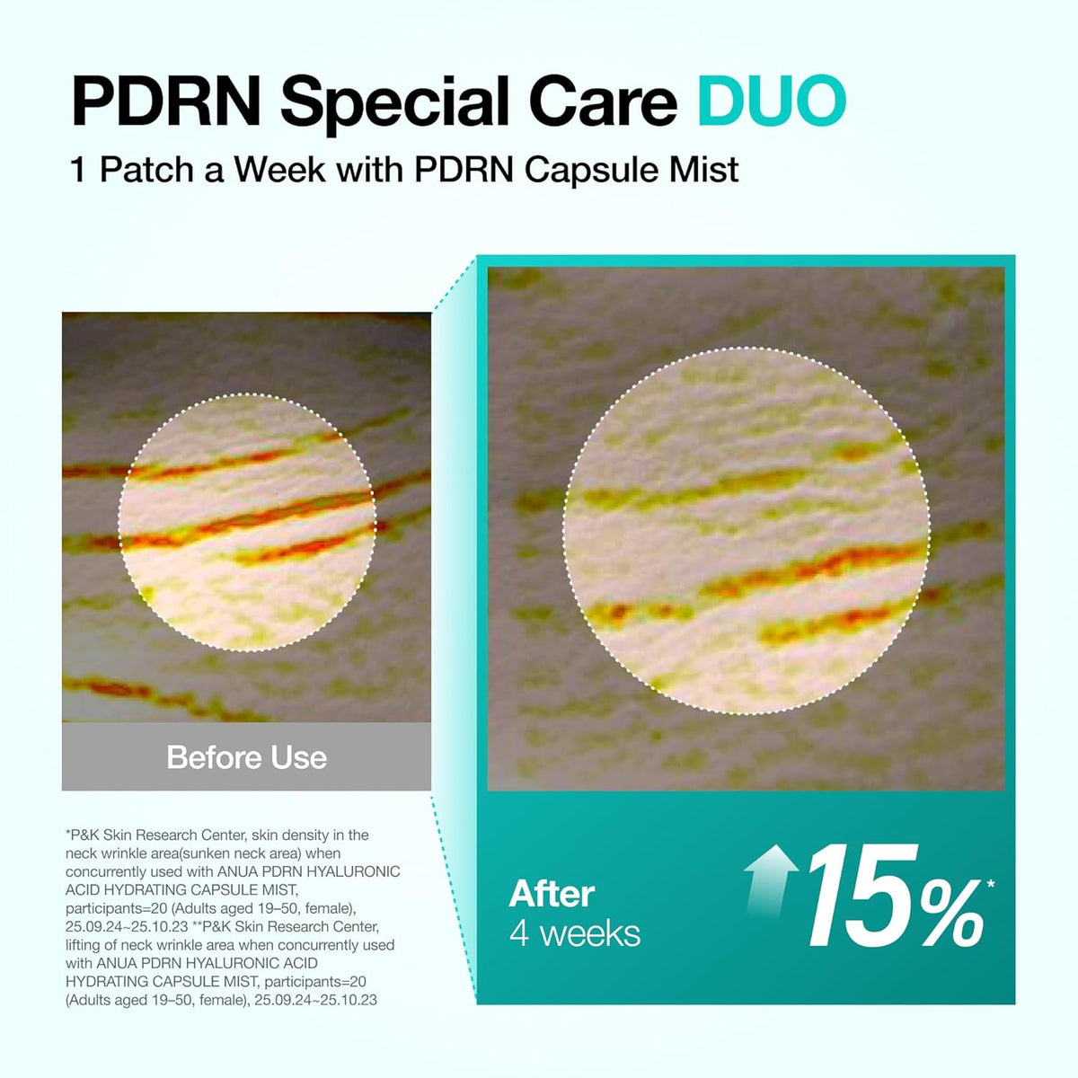 ANUA PDRN Collagen Melting Patch For Neck – 4 Patches
