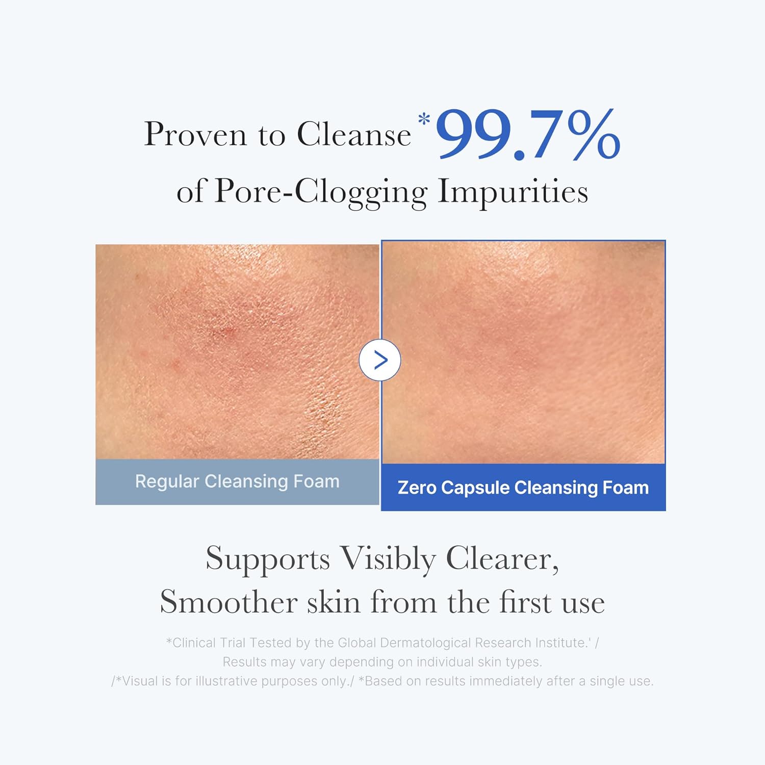 Medicube – Zero Pore SA Clear Capsule Cleansing Foam 120g