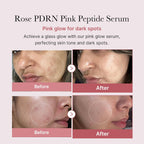 Medicube PDRN Pink Peptide Serum – 30ml
