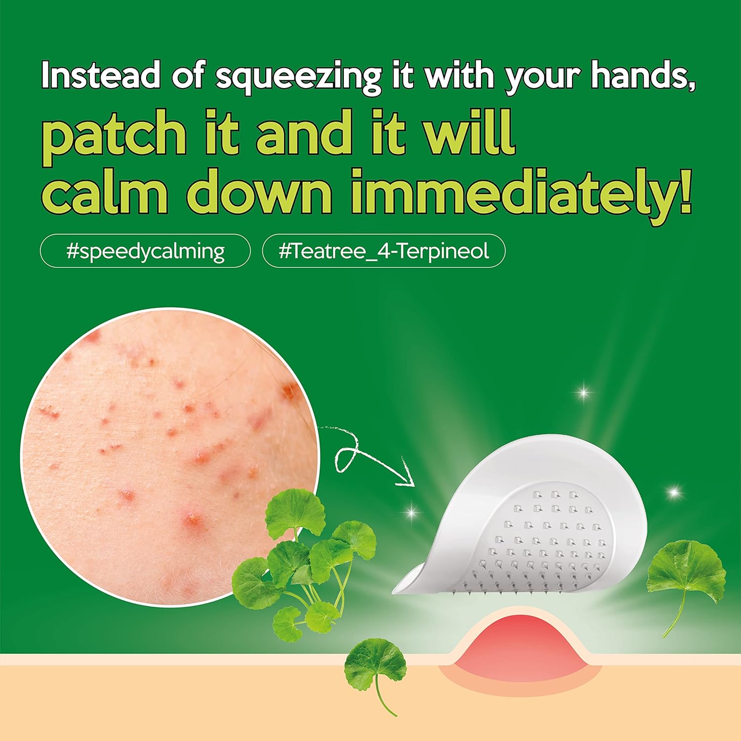 Troubless Micro-Point Patch (9 Patches)