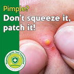 Troubless Micro-Point Patch (9 Patches)