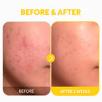 TIRTIR Pure Vitamin C24 Brightening & Firming Serum - 30 ml