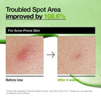 Anua Azelaic Acid 10% + Hyaluron Redness Soothing Serum 30ml