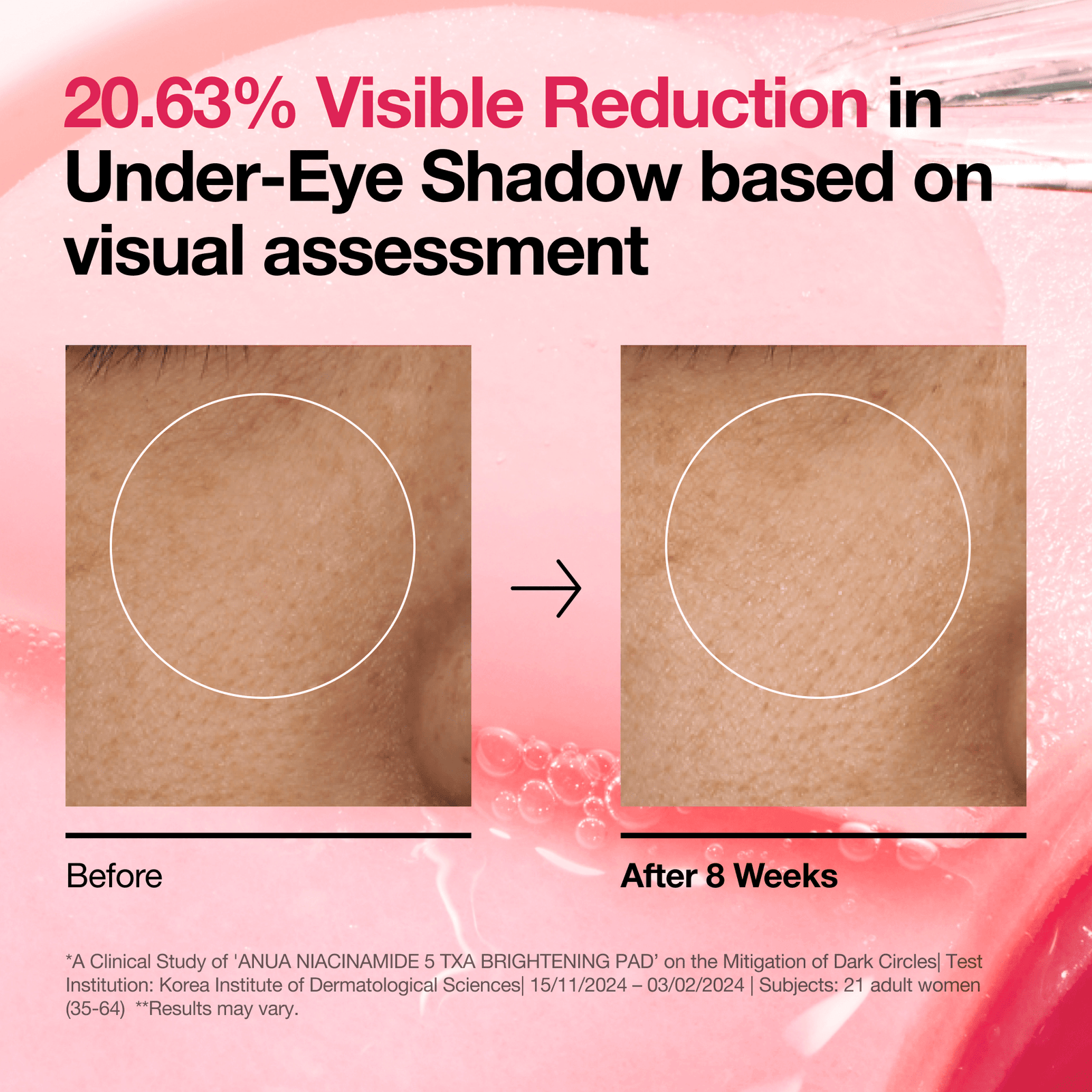 ANUA Niacinamide 5 TXA Brightening Pad 60EA 210ml