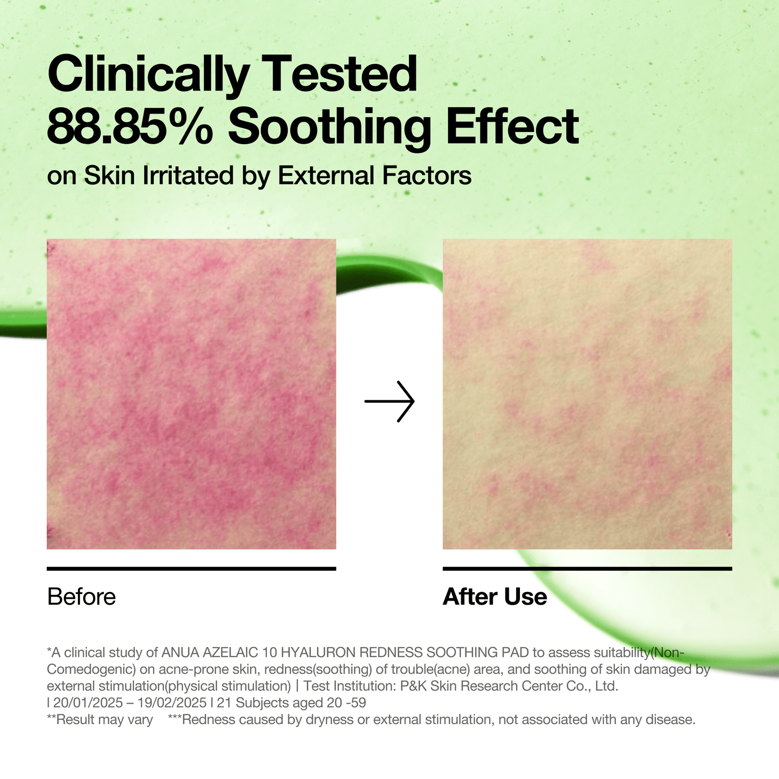 ANUA Azelaic 10 Hyaluron Redness Soothing Pad 90ea 230ml
